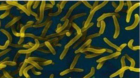 微生物菌劑好？好在哪里您知道嗎？